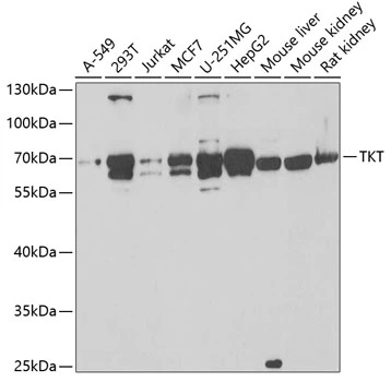 WB analysis of various sample lysates using GTX16442 Transketolase antibody. The signal was developed with ECL plus-Enhanced. Dilution : 1:1000 Loading : 25microg per lane WB analysis of various sample lysates using GTX16442 Transketolase antibody. The signal was developed with ECL plus-Enhanced. Dilution : 1:1000 Loading : 25microg per lane