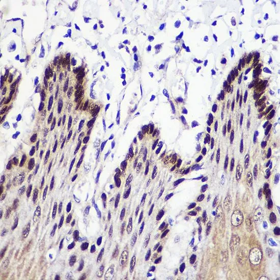 IHC-P analysis of human esophageal tissue using GTX16442 Transketolase antibody. Dilution : 1:50