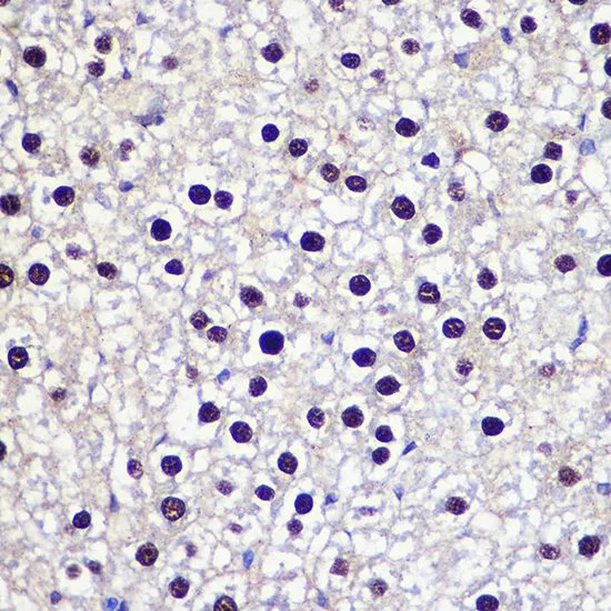 IHC-P analysis of rat liver tissue using GTX16442 Transketolase antibody. Dilution : 1:50