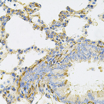 IHC-P analysis of rat lung tissue using GTX16443 UBE2B antibody. Dilution : 1:100