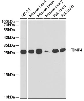 WB analysis of various sample lysates using GTX16463 TIMP4 antibody. Dilution : 1:1000 Loading : 25microg per lane WB analysis of various sample lysates using GTX16463 TIMP4 antibody. Dilution : 1:1000 Loading : 25microg per lane
