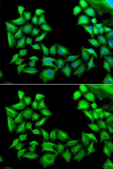ICC/IF analysis of U2OS cells using GTX16463 TIMP4 antibody. Blue : DAPI