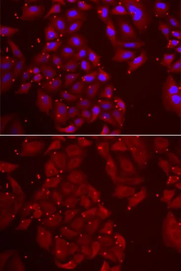 ICC/IF analysis of U2OS cells using GTX16466 Tripeptidyl peptidase II antibody. Blue : DAPI