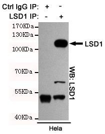 WB analysis of various cell lysates using LSD1 antibody [1E5-H2] at a dilution of 1:1000.
