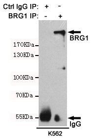 WB analysis of various cell lysates using BRG1 antibody [4E11-E11-G11] at a dilution of 1:1000.