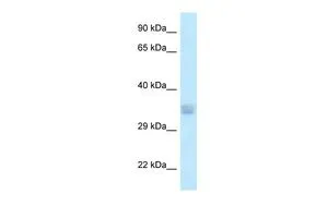 WB analysis of human B lymphoblast cells using GTX16544 ACOT8 antibody at 1.0microg/ml.