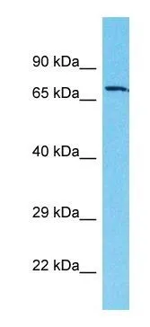 WB analysis of NCI-H226 cells using GTX16571 ACOX2 antibody at 1.0microg/ml. WB analysis of NCI-H226 cells using GTX16571 ACOX2 antibody at 1.0microg/ml.