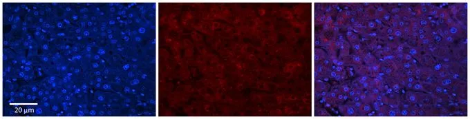 IHC-P analysis of human liver tissue using GTX16572 ABHD14A antibody at 1:100. Left to right : DAPI, ABHD14A, Merge. Low pH, heat-induced antigen retrieval method utilizing Sodium Citrate buffer was performed. IHC-P analysis of human liver tissue using GTX16572 ABHD14A antibody at 1:100. Left to right : DAPI, ABHD14A, Merge. Low pH, heat-induced antigen retrieval method utilizing Sodium Citrate buffer was performed.