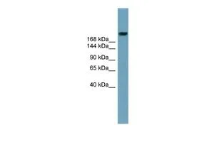 WB analysis of human fetal stomach tissue using GTX16583 ABCA12 antibody at 0.2-1microg/ml. WB analysis of human fetal stomach tissue using GTX16583 ABCA12 antibody at 0.2-1microg/ml.