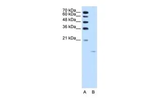 IHC-P analysis of human kidney tissue using GTX16588 ACP1 antibody at 4.0-8.0ug/ml.