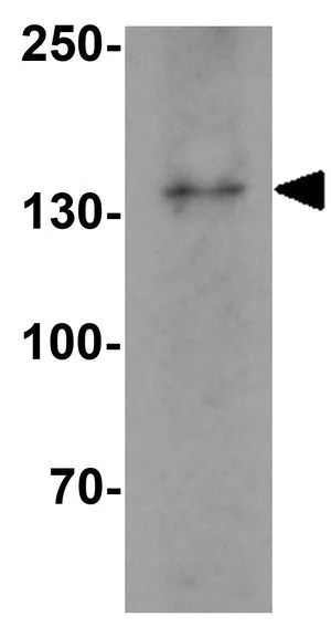 WB analysis of A-20 cell lysate using GTX16598 IL17 Receptor alpha antibody. Working concentration : 1 microg/ml WB analysis of A-20 cell lysate using GTX16598 IL17 Receptor alpha antibody. Working concentration : 1 microg/ml