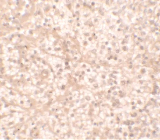 IHC-P analysis of human spleen tissue using GTX16598 IL17 Receptor alpha antibody. Working concentration : 2.5 microg/ml