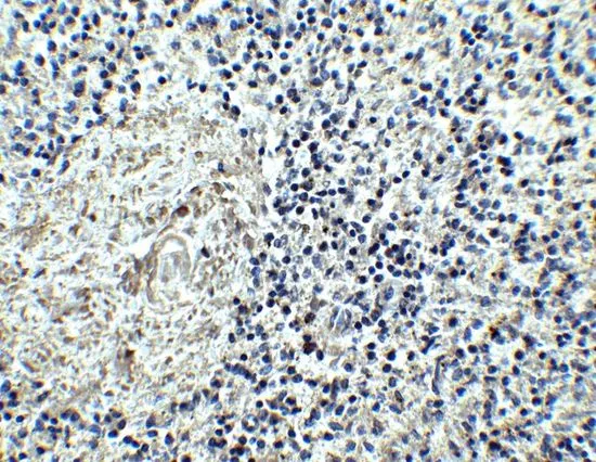 IHC-P analysis of human spleen tissue using GTX16598 IL17 Receptor alpha antibody. Working concentration : 2.5 microg/ml