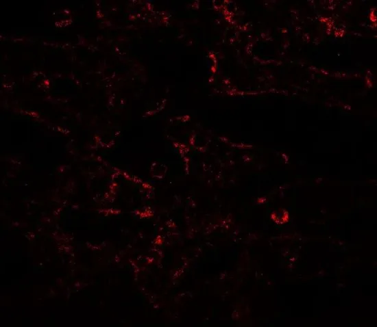 IHC-P analysis of human spleen tissue using GTX16598 IL17 Receptor alpha antibody. Working concentration : 20 microg/ml