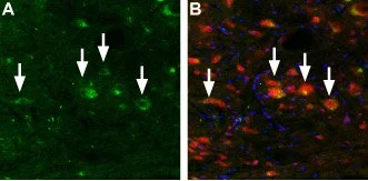 IHC-Fr analysis of mouse brain stem tissue using GTX16617 MCOLN3 antibody. DAPI is used as the counterstain (blue). Panel A : TRPML3 (green) appears in neurons (arrows) in the area of the dorsal cochlear nucleus. Panel B : Staining of the same section with mouse anti-parvalbumin (red) reveals that the TRPML3 appears in a subset of neurons in this nucleus. IHC-Fr analysis of mouse brain stem tissue using GTX16617 MCOLN3 antibody. DAPI is used as the counterstain (blue). Panel A : TRPML3 (green) appears in neurons (arrows) in the area of the dorsal cochlear nucleus. Panel B : Staining of the same section with mouse anti-parvalbumin (red) reveals that the TRPML3 appears in a subset of neurons in this nucleus.