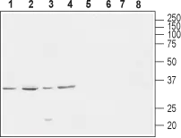 WB analysis of rat brain (lanes 1 and 5), mouse brain (lanes 2 and 6), SH-SY5Y (lanes 3 and 7) and PC12 (lanes 4 and 8) lysates using GTX16625 Cav gamma 4 antibody preincubated with or without immunogen peptide. Dilution : 1:800 WB analysis of rat brain (lanes 1 and 5), mouse brain (lanes 2 and 6), SH-SY5Y (lanes 3 and 7) and PC12 (lanes 4 and 8) lysates using GTX16625 Cav gamma 4 antibody preincubated with or without immunogen peptide. Dilution : 1:800