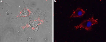 Live cell imaging analysis of intact living PC12 cells using GTX16626 Cav gamma 5 antibody. Red : Primary antibody Blue : DAPI for nuclear staining Dilution : 1:25