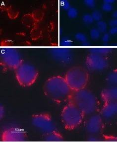 Live cell imaging analysis of living rat cerebral artery smooth muscle cells using GTX16629 TRPC6 antibody. in the absence (upper left) and in the presence (lower left) of the control peptide antigen Dilution :