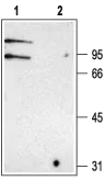 WB analysis of rat kidney membrane lysate using GTX16636 CLCNKA + CLCNKB antibody preincubated with or without immunogen peptide. Dilution : 1:200 WB analysis of rat kidney membrane lysate using GTX16636 CLCNKA + CLCNKB antibody preincubated with or without immunogen peptide. Dilution : 1:200