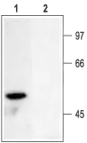 WB analysis of rat brain membrane lysate using GTX16638 Kv1.6 antibody preincubated with or without immunogen peptide. Dilution : 1:200 WB analysis of rat brain membrane lysate using GTX16638 Kv1.6 antibody preincubated with or without immunogen peptide. Dilution : 1:200