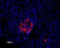 IHC-P analysis of rat pancreas tissue using GTX16640 Kv2.1 antibody. Endocrine (Islets of ?Langerhans) and exocrine areas of pancreas section are shown. Strong and highly specific KV2.1 staining is evident only in endocrine cells (red). Hoechst 33342 is used as the counterstain (blue). Dilution : 1:50 IHC-P analysis of rat pancreas tissue using GTX16640 Kv2.1 antibody. Endocrine (Islets of ?Langerhans) and exocrine areas of pancreas section are shown. Strong and highly specific KV2.1 staining is evident only in endocrine cells (red). Hoechst 33342 is used as the counterstain (blue). Dilution : 1:50