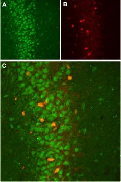IHC-Fr analysis of rat hippocampus tissue using GTX16645 KCNMB2 antibody. Panel A : KCNMB2 ?appears in the pyramidal layer (green). Panel B : Staining of interneurons with mouse anti-parvalbumin (PV, red). Panel C : Merge of KCNMB2? and PV demonstrates presence of KCNMB2 also in PV (GABA containing) cells (orange). IHC-Fr analysis of rat hippocampus tissue using GTX16645 KCNMB2 antibody. Panel A : KCNMB2 ?appears in the pyramidal layer (green). Panel B : Staining of interneurons with mouse anti-parvalbumin (PV, red). Panel C : Merge of KCNMB2? and PV demonstrates presence of KCNMB2 also in PV (GABA containing) cells (orange).