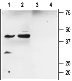 Anti-slobeta2_(KCNMB2) - Expression of slobeta2 in rat hippocampus Immunohistochemical staining of rat hippocampus using Anti-slo?2 (KCNMB2).