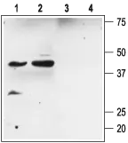 WB analysis of rat kidney (lanes 1 and 3) and heart (lanes 2 and 4) membrane lysates using GTX16645 KCNMB2 antibody preincubated with or without immunogen peptide. Dilution : 1:200