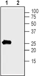 WB analysis of rat colon lysate using GTX16646 KCNMB1 antibody preincubated with or without immunogen peptide. Dilution : 1:400 WB analysis of rat colon lysate using GTX16646 KCNMB1 antibody preincubated with or without immunogen peptide. Dilution : 1:400
