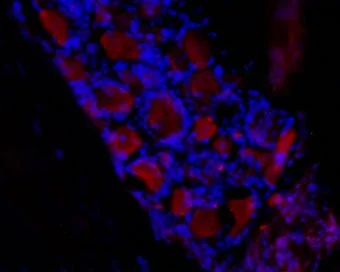 IHC-Fr analysis of rat dorsal root ganglia (DRG) tissue using GTX16656 HCN3 antibody. Staining is present in neuronal cell bodies. Hoechst 33342 (blue) is used as counterstain. Dilution : 1:50 IHC-Fr analysis of rat dorsal root ganglia (DRG) tissue using GTX16656 HCN3 antibody. Staining is present in neuronal cell bodies. Hoechst 33342 (blue) is used as counterstain. Dilution : 1:50