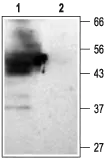 WB analysis of rat kidney membrane lysate using GTX16664 KCNJ15 antibody preincubated with or without immunogen peptide. Dilution : 1:200 WB analysis of rat kidney membrane lysate using GTX16664 KCNJ15 antibody preincubated with or without immunogen peptide. Dilution : 1:200