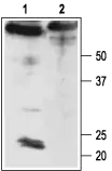 WB analysis of rat brain membrane lysate using GTX16666 KCNMB4 antibody preincubated with or without immunogen peptide. Dilution : 1:200