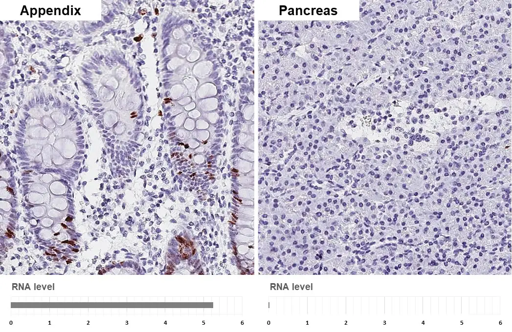 EGC6枚 Anti-Ki67 antibody [SP6] (GTX16667) | GeneTex