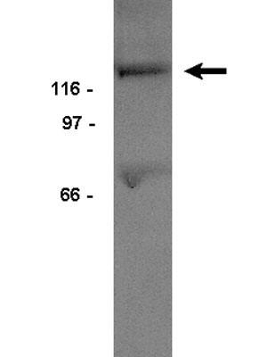 WB analysis of mouse brain tissue lysate using GTX16672 PYK2 antibody. Dilution : 0.5microg/ml WB analysis of mouse brain tissue lysate using GTX16672 PYK2 antibody. Dilution : 0.5microg/ml