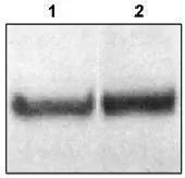 GTX16675 at 1g/ml staining mouse DGTX1 (80kDa) in mouse brain extract by Western blot. Lane 1: GTX16674 (N terminal). Lane 2: GTX16675 (C terminal).