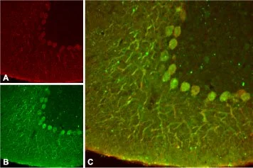 IHC-Fr analysis of rat cerebellum tissue using GTX16684 KCNK4 antibody. Panel A : KCNK4 channel appears in Purkinje neuronal processes (red). Panel B : Staining of Purkinje nerve cells with mouse anti-calbindin D28K (a calcium binding protein, green). Panel C : Merge of KCNK4 channel and calbindin D28K demonstrates the co-localization of these proteins. IHC-Fr analysis of rat cerebellum tissue using GTX16684 KCNK4 antibody. Panel A : KCNK4 channel appears in Purkinje neuronal processes (red). Panel B : Staining of Purkinje nerve cells with mouse anti-calbindin D28K (a calcium binding protein, green). Panel C : Merge of KCNK4 channel and calbindin D28K demonstrates the co-localization of these proteins.