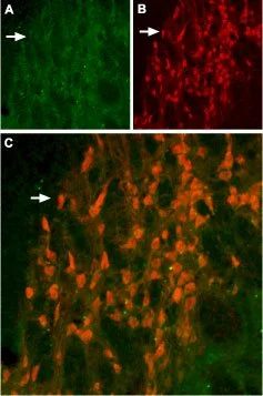 IHC-Fr analysis of rat hippocampus tissue using GTX16688 KCNH6 antibody. Panel A :? Kv11.2 appears as diffuse staining (green) that defines the boundary of the reticular nucleus of thalamus (arrow). Panel B : Staining with mouse anti-parvalbumin (PV, red) demonstrates both neuronal and diffuse staining. Panel C : Merge of KV11.2 and PV demonstrates overlap of the two markers labeling the reticular nucleus of the thalamus (orange). IHC-Fr analysis of rat hippocampus tissue using GTX16688 KCNH6 antibody. Panel A :? Kv11.2 appears as diffuse staining (green) that defines the boundary of the reticular nucleus of thalamus (arrow). Panel B : Staining with mouse anti-parvalbumin (PV, red) demonstrates both neuronal and diffuse staining. Panel C : Merge of KV11.2 and PV demonstrates overlap of the two markers labeling the reticular nucleus of the thalamus (orange).