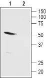 WB analysis of rat kidney membrane lysate using GTX16693 KCNK13 antibody preincubated with or without immunogen peptide. Dilution : 1:200