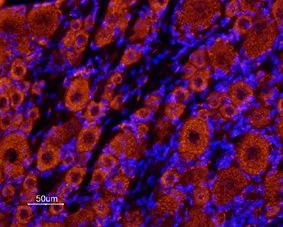 IHC-Fr analysis of rat dorsal root ganglia tissue using GTX16694 TRESK antibody. Both big/medium sized neurons and small neurons are stained. Note that glial cells and axonal fibers are not stained. Hoechst 33342 is used as the counterstain (blue staining). Dilution : 1:100 IHC-Fr analysis of rat dorsal root ganglia tissue using GTX16694 TRESK antibody. Both big/medium sized neurons and small neurons are stained. Note that glial cells and axonal fibers are not stained. Hoechst 33342 is used as the counterstain (blue staining). Dilution : 1:100