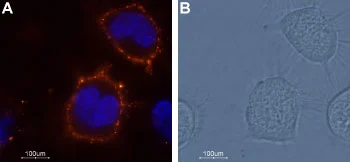 Live cell imaging analysis of living ND7/23 cells using GTX16694 TRESK antibody. Orange : Primary antibody Blue : Hoechst 33342 for nuclear staining Dilution : 1:50