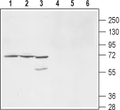 WB analysis of mouse (lanes 1 and 4), and rat (lanes 2 and 5) brain membrane, and HL-60 (lanes 3 and 6) cell lysates using GTX16708 Kv9.1 antibody preincubated with or without immunogen peptide. Dilution : 1:200 WB analysis of mouse (lanes 1 and 4), and rat (lanes 2 and 5) brain membrane, and HL-60 (lanes 3 and 6) cell lysates using GTX16708 Kv9.1 antibody preincubated with or without immunogen peptide. Dilution : 1:200