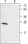 WB analysis of rat brain lysate using GTX16713 KCNIP1 antibody preincubated with or without immunogen peptide. Dilution : 1:200 WB analysis of rat brain lysate using GTX16713 KCNIP1 antibody preincubated with or without immunogen peptide. Dilution : 1:200