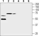 WB analysis of rat heart membrane (lanes 1 and 4), mouse brain membrane (lanes 2 and 5) and rat brain membrane (lanes 3 and 6) lysates using GTX16774 Kv1.2 antibody preincubated with or without immunogen peptide. Dilution : 1:200 WB analysis of rat heart membrane (lanes 1 and 4), mouse brain membrane (lanes 2 and 5) and rat brain membrane (lanes 3 and 6) lysates using GTX16774 Kv1.2 antibody preincubated with or without immunogen peptide. Dilution : 1:200