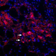 IHC-Fr analysis of rat lateral dorsal raphe nucleus tissue using GTX16778 KCNQ4 antibody. Staining appears in soma of neuronal profiles (arrows). Nuclei are stained with DAPI (blue). Dilution : 1:400 IHC-Fr analysis of rat lateral dorsal raphe nucleus tissue using GTX16778 KCNQ4 antibody. Staining appears in soma of neuronal profiles (arrows). Nuclei are stained with DAPI (blue). Dilution : 1:400