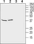 WB analysis of rat brain (lanes 1 and 3) and mouse brain (lanes 2 and 4) lysates using GTX16785 Kir4.1 antibody preincubated with or without immunogen peptide. Dilution : 1:500 WB analysis of rat brain (lanes 1 and 3) and mouse brain (lanes 2 and 4) lysates using GTX16785 Kir4.1 antibody preincubated with or without immunogen peptide. Dilution : 1:500