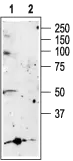 WB analysis of rat brain membrane lysate using GTX16812 P2X5 antibody preincubated with or without immunogen peptide. Dilution : 1:200