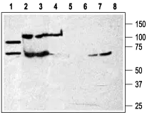 WB analysis of rat brain membrane (lanes 1,5), K562 (lanes 2 and 6), WEHI-231 (lanes 3 and 7), and HL-60 (lanes 4 and 8) lysates using GTX16827 P2X7 antibody preincubated with or without immunogen peptide.<br>Dilution : 1:200