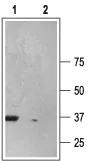 WB analysis of rat brain membrane lysate using GTX16843 P2X6 antibody preincubated with or without immunogen peptide. Dilution : 1:200 WB analysis of rat brain membrane lysate using GTX16843 P2X6 antibody preincubated with or without immunogen peptide. Dilution : 1:200