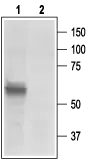 WB analysis of rat DRG lysate using GTX16876 P2X3 antibody preincubated with or without immunogen peptide. Dilution : 1:200
