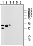 WB analysis of rat heart membranes (lanes 1 and 4), brain (lanes 2 and 5), and lung (lanes 3 and 6) lysates using GTX16887 GPR105 antibody preincubated with or without immunogen peptide.<br>Dilution : 1:200